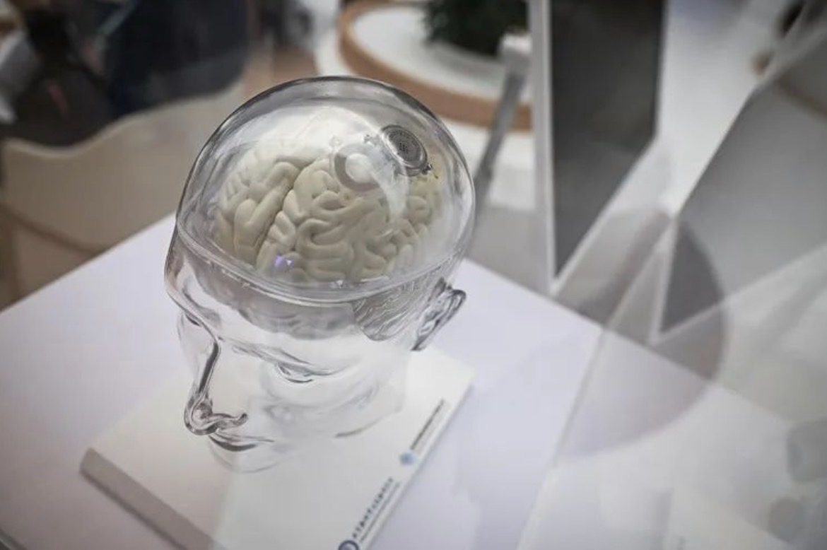 Array半年盘点｜中国脑机接口进入临床试验，拓展消费级应用场景